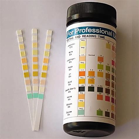 urinalysis test strips boots.